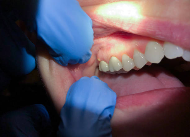 Best Emergency Gum Pain Relief  in Lonaconing, MD